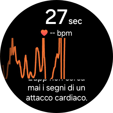 Risultati ECG: cosa mostrano davvero le schermate