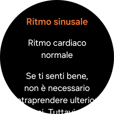 Come interpretare i risultati ECG sugli smartwatch Samsung Galaxy